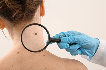 Doctor Checking Woman's Mole
